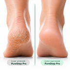 PureStep Pro